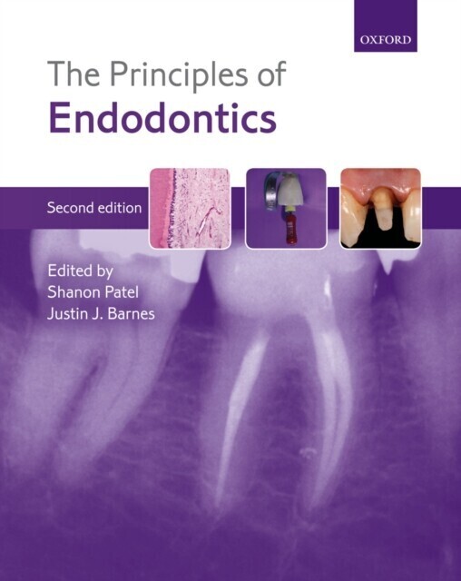 Principles of Endodontics main product photo