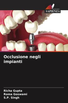 Occlusione negli impianti