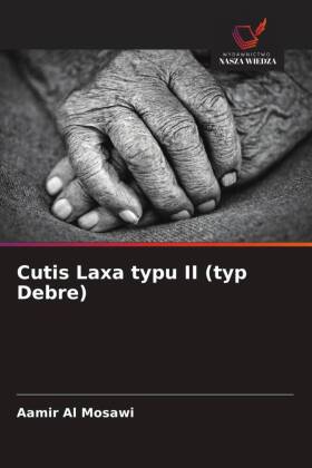 Cutis Laxa typu II (typ Debre)