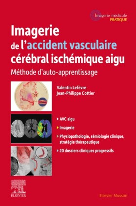 Imagerie de l'accident vasculaire cérébral ischémique aigu