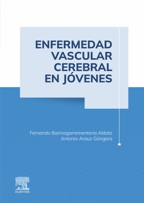 Enfermedad vascular cerebral en jóvenes