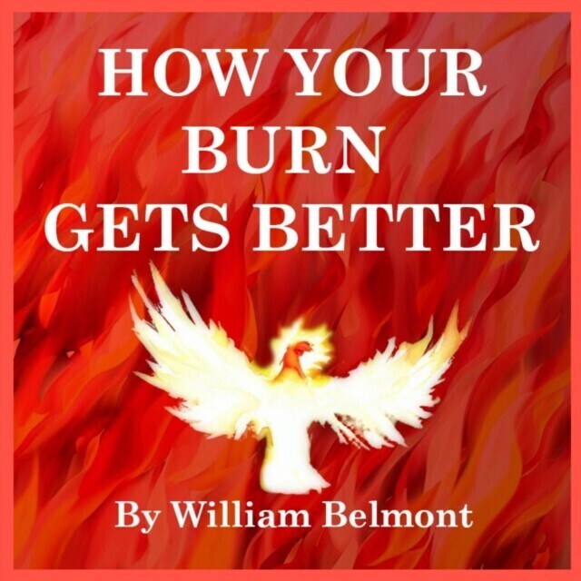 HOW YOUR BURN GETS BETTER main product photo