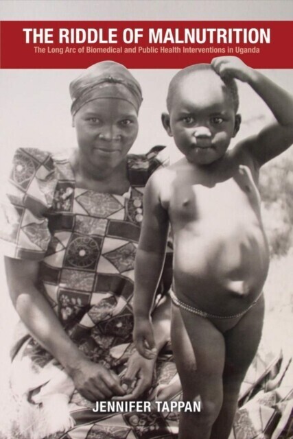 The Riddle of Malnutrition main product photo