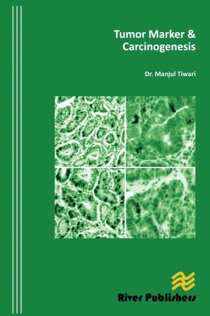 Tumor Marker and Carcinogenesis main product photo