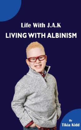 Life With J.A.K  Living with Albinism