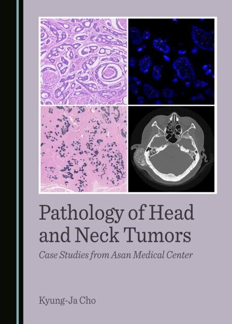 Pathology of Head and Neck Tumors main product photo