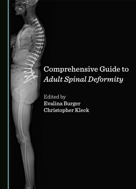 Comprehensive Guide to Adult Spinal Deformity main product photo