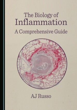 Biology of Inflammation