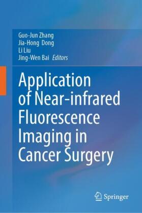 Application of Near-infrared Fluorescence Imaging in Cancer Surgery