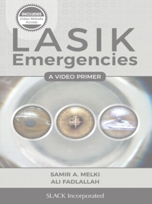 LASIK Emergencies