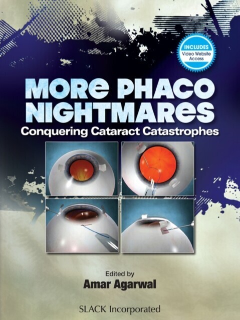 More Phacoo Nightmares main product photo