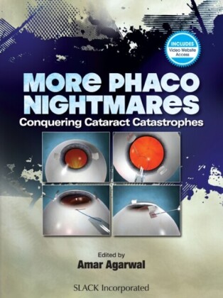 More Phacoo Nightmares