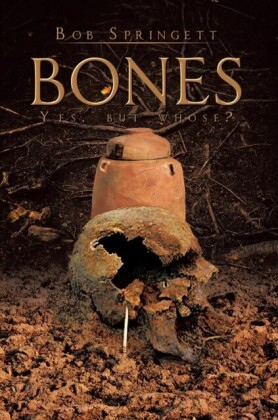 Bones