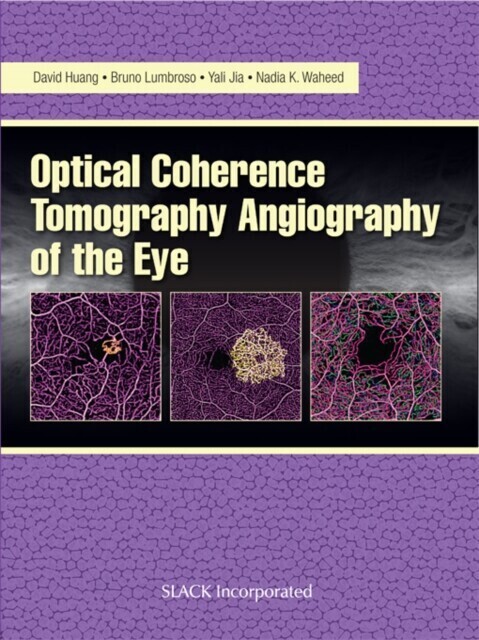 Optical Coherencre Tomography Angiography of the Eye main product photo