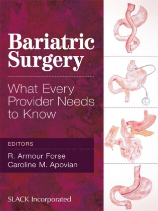 Bariatric Surgery