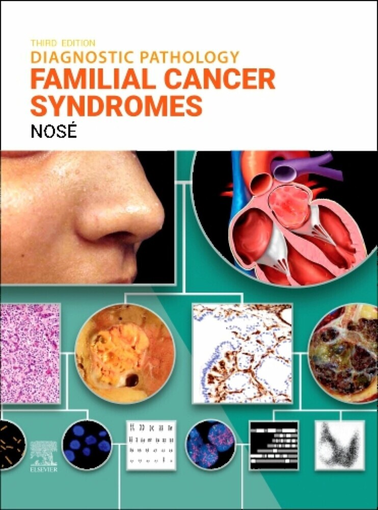 Diagnostic Pathology: Familial Cancer Syndromes - E-Book main product photo
