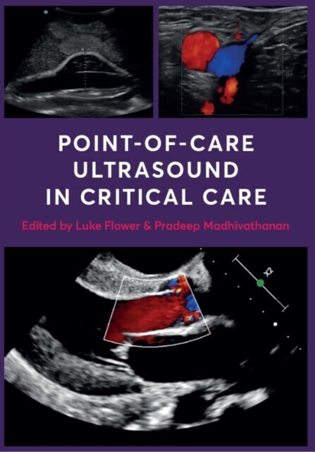 Point-of-Care Ultrasound in Critical Care main product photo