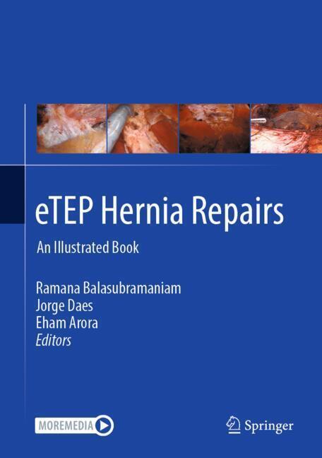 eTEP Hernia Repairs main product photo