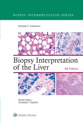 Biopsy Interpretation of the Liver