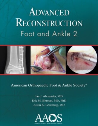 Advanced Reconstruction: Foot and Ankle 2