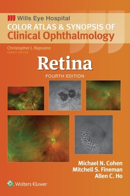 Retina main product photo