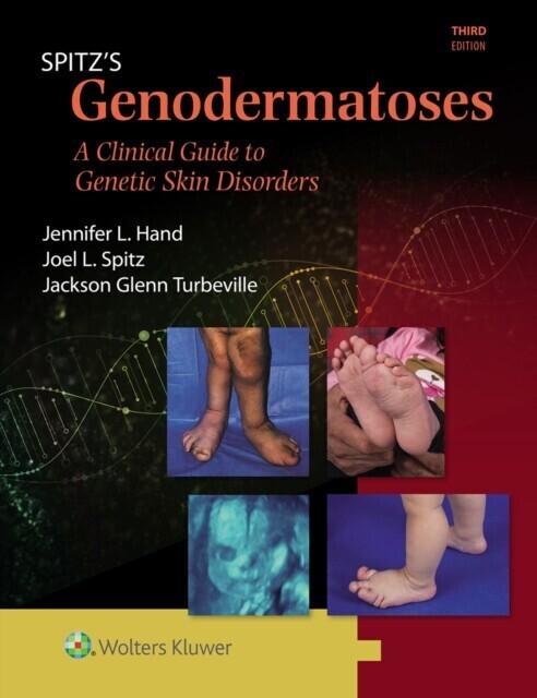 Spitz's Genodermatoses main product photo