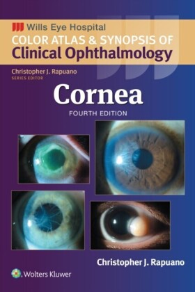 Cornea
