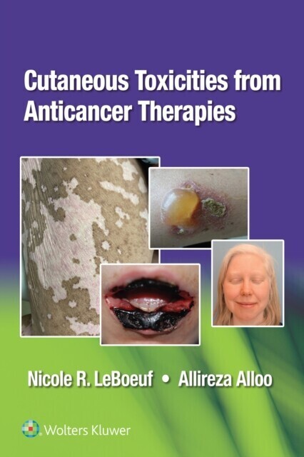Cutaneous Reactions from Anticancer Therapies main product photo