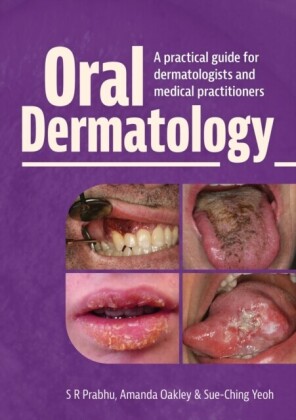Oral Dermatology