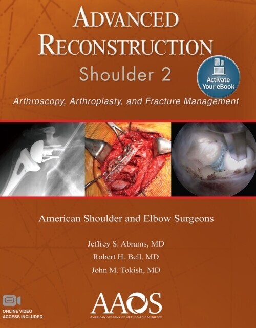 Advanced Reconstruction: Shoulder 2 main product photo
