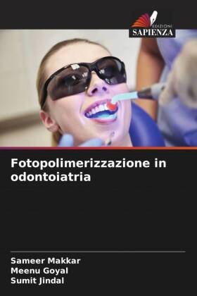 Fotopolimerizzazione in odontoiatria