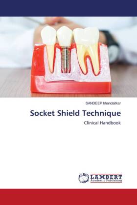 Socket Shield Technique