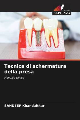 Tecnica di schermatura della presa