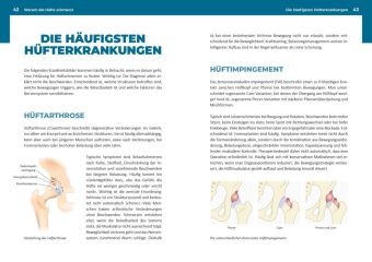 Neustart für die Hüfte