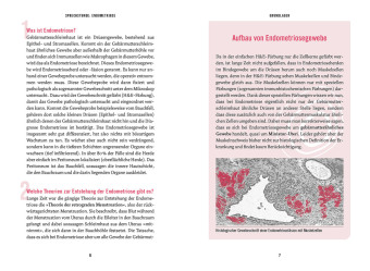 In der Sprechstunde: Endometriose; Erkennen - Verstehen -Behandeln