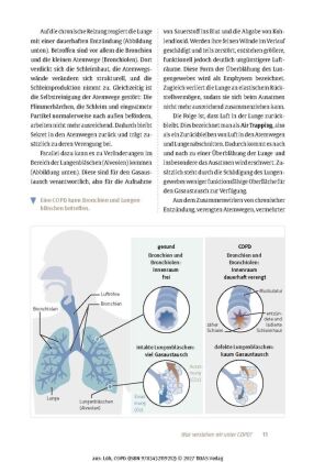 Expertenwissen: COPD