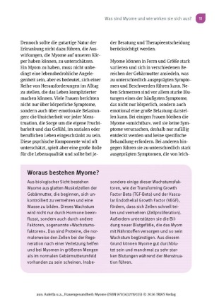 Frauengesundheit: Myome