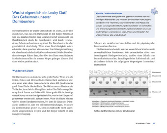 Leaky Gut und SIBO