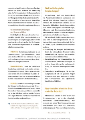 Expertenwissen: Rheuma