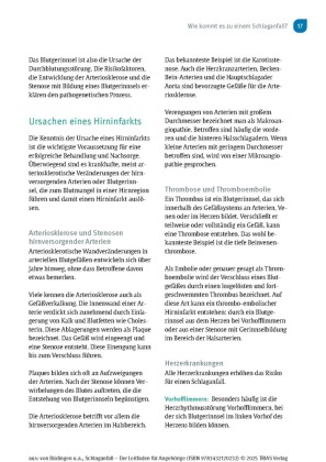 Schlaganfall - Der Leitfaden für Angehörige