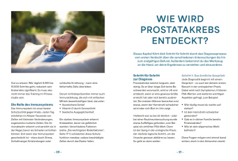 Prostatakrebs - Dein Wegweiser zur richtigen Behandlung