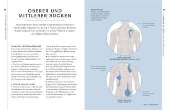 Triggerpunkte 