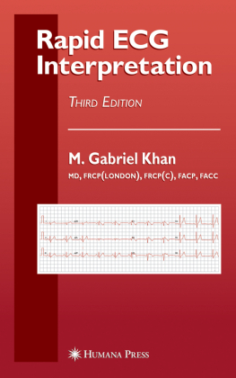 Rapid ECG Interpretation 
