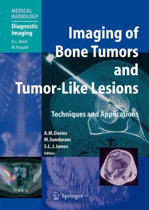 Imaging of Bone Tumors and Tumor-Like Lesions - Michaelsbund