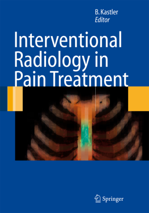 Interventional Radiology in Pain Treatment 