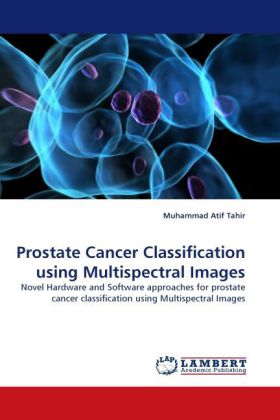 Prostate Cancer Classification using Multispectral Images 