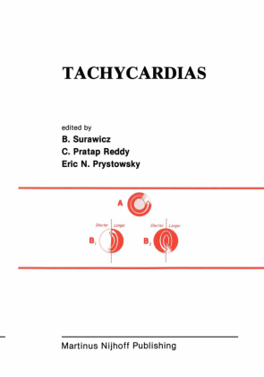 Tachycardias 