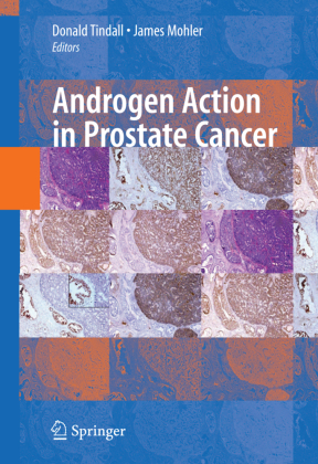Androgen Action in Prostate Cancer 