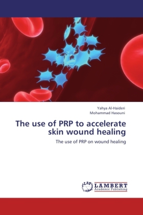 The use of PRP to accelerate skin wound healing 