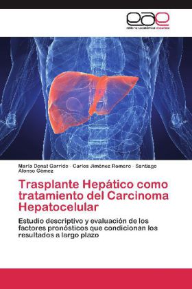 Trasplante Hepático como tratamiento del Carcinoma Hepatocelular 